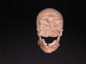 presunto cranio plinio